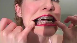 Mouth Bizarre Braces Red Lipstick with Kinky Talk